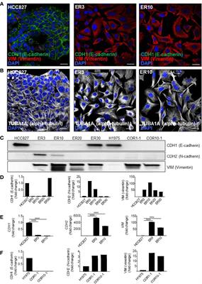 Intrinsic Differences in Spatiotemporal Organization and Stromal Cell Interactions Between Isogenic Lung Cancer Cells of Epithelial and Mesenchymal Phenotypes Revealed by High-Dimensional Single-Cell Analysis of Heterotypic 3D Spheroid Models